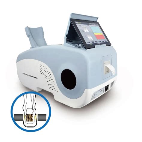 dexa scan philippines|Bone Mineral Densitometry Unit .